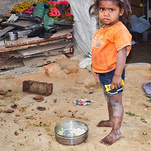 Food and home for children cause